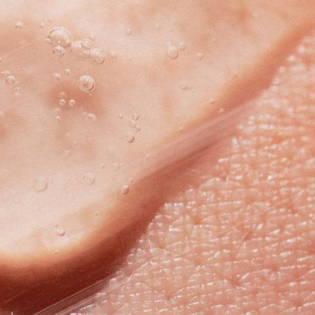 Qu’est-ce qui donne à la peau une sensation granuleuse ?