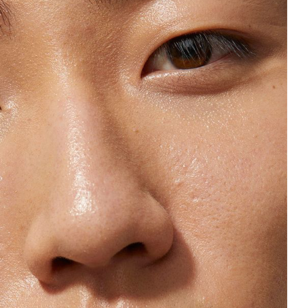 Est-ce que les probiotiques sont bons pour la peau ?