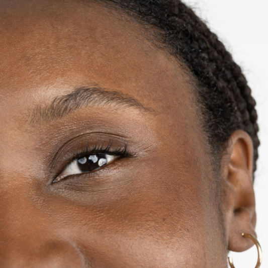 Cernes, poches sous les yeux et paupières tombantes : le lifting est-il une opération efficace ?