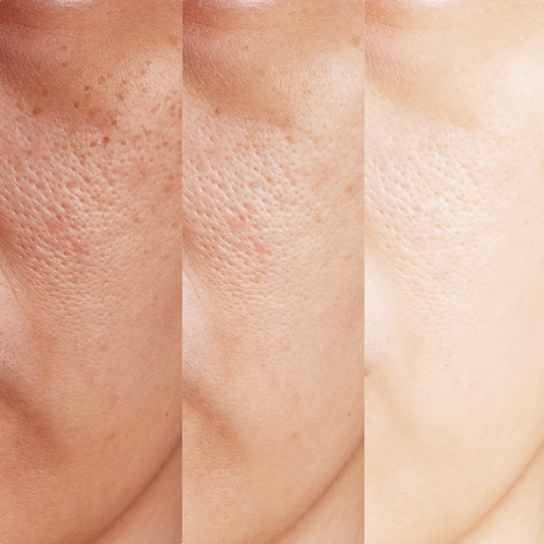 Peau déshydratée : Comment la reconnaître et l'éviter ?