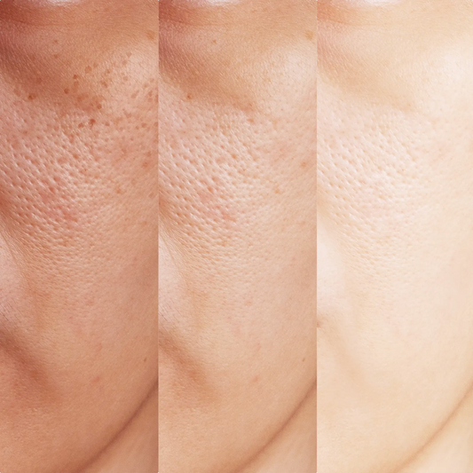 Peau déshydratée : Comment la reconnaître et l'éviter ?