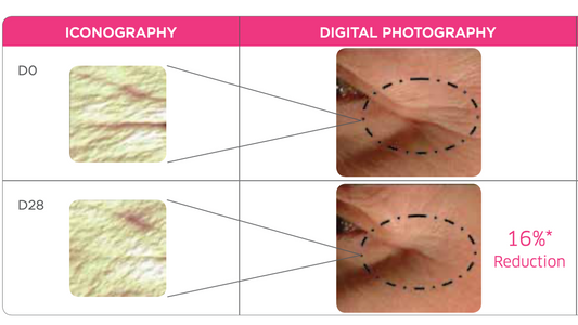 Qu'est-ce que l'acetyl tetrapeptide et ses bienfaits ?