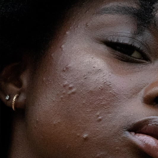 All you need to know about the physiology and function of the sebaceous glands