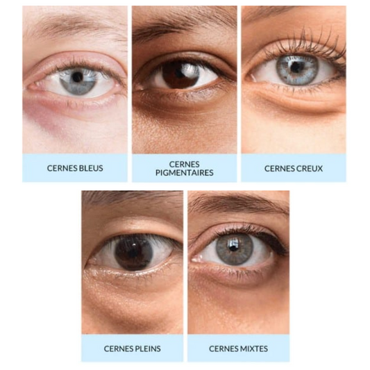 How can I make dark circles disappear?