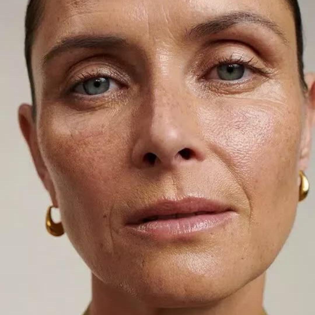 What are the most common wrinkles and how can they be corrected?