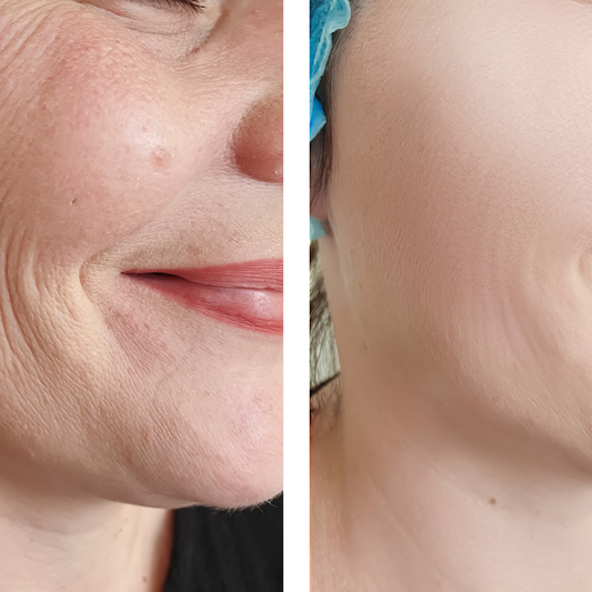 What's the best anti-wrinkle product?