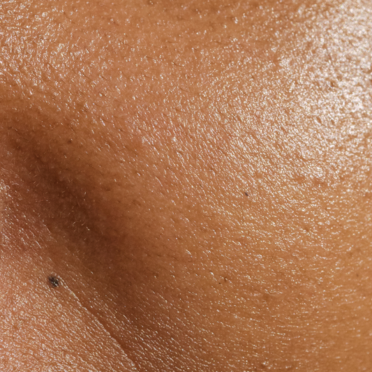 What are the different skin types and how can you even out your complexion?