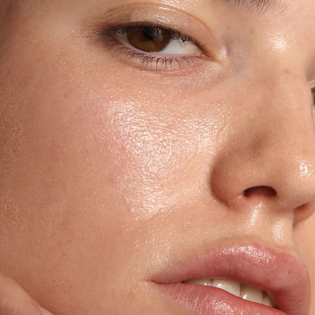 Mistakes not to make when you have dilated pores