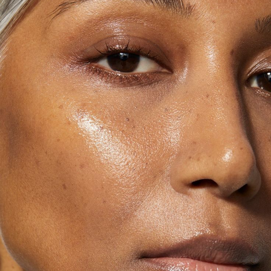 What's the difference between wrinkles and fine lines?
