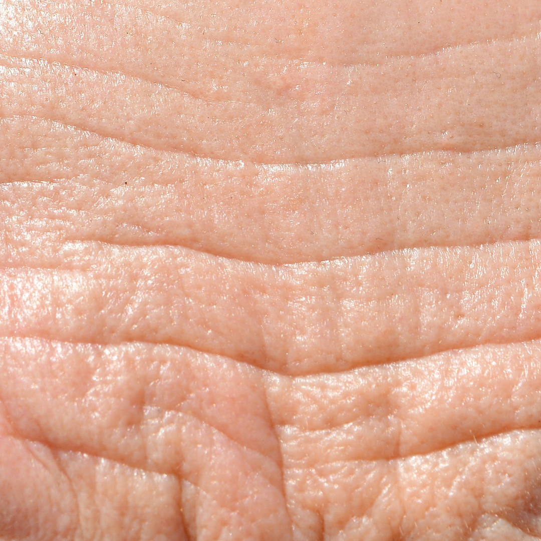 Wrinkles and fine lines - how to reduce them?