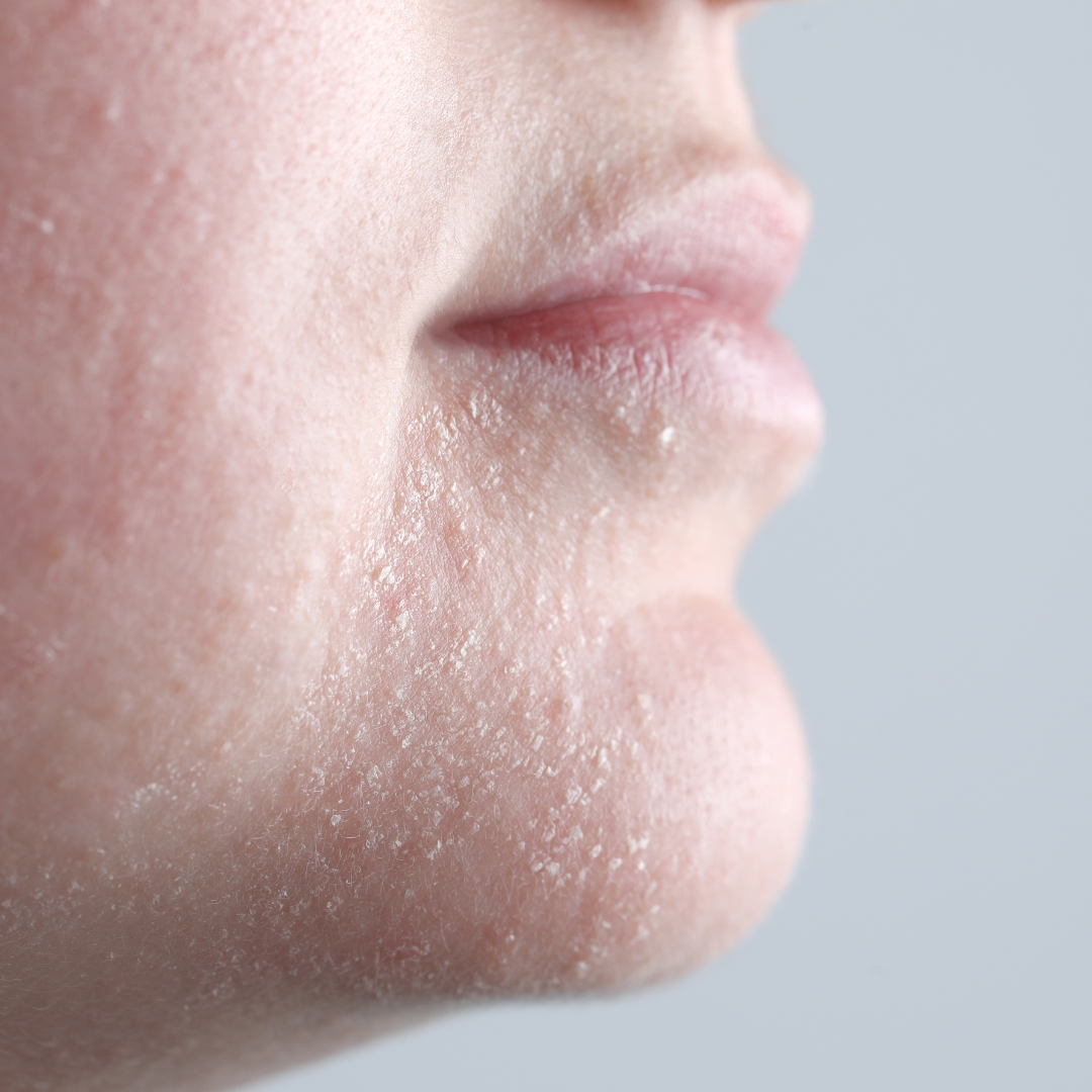 Sensitive and reactive skin | how to care for it?