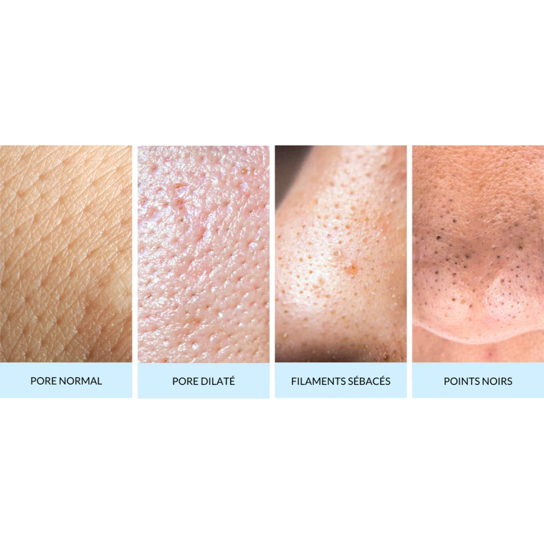 Quel est le rôle des pores de la peau et comment les resserrer ?