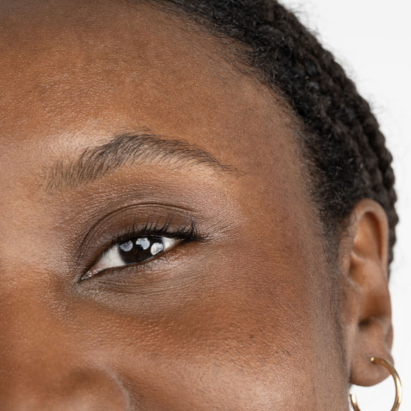 Cernes, poches sous les yeux et paupières tombantes : le lifting est-il une opération efficace ?
