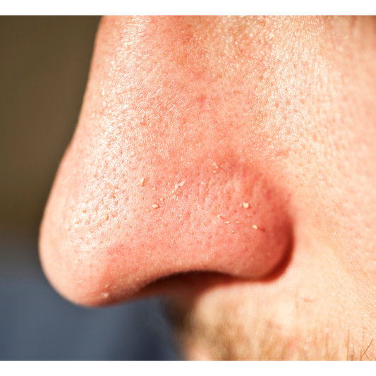 Quel sérum choisir pour mes imperfections ?