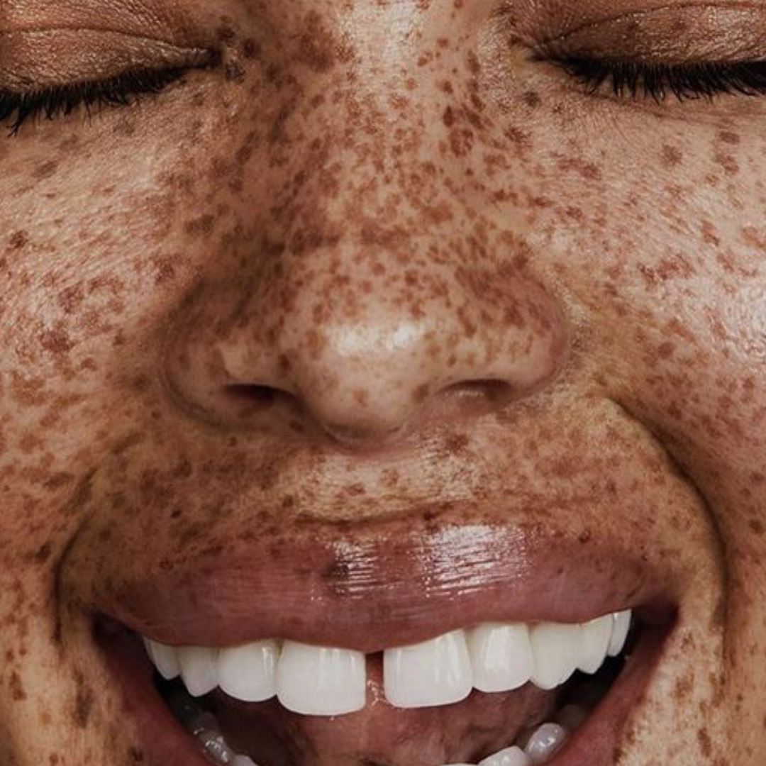 Comment reconnaitre la peau normale ?