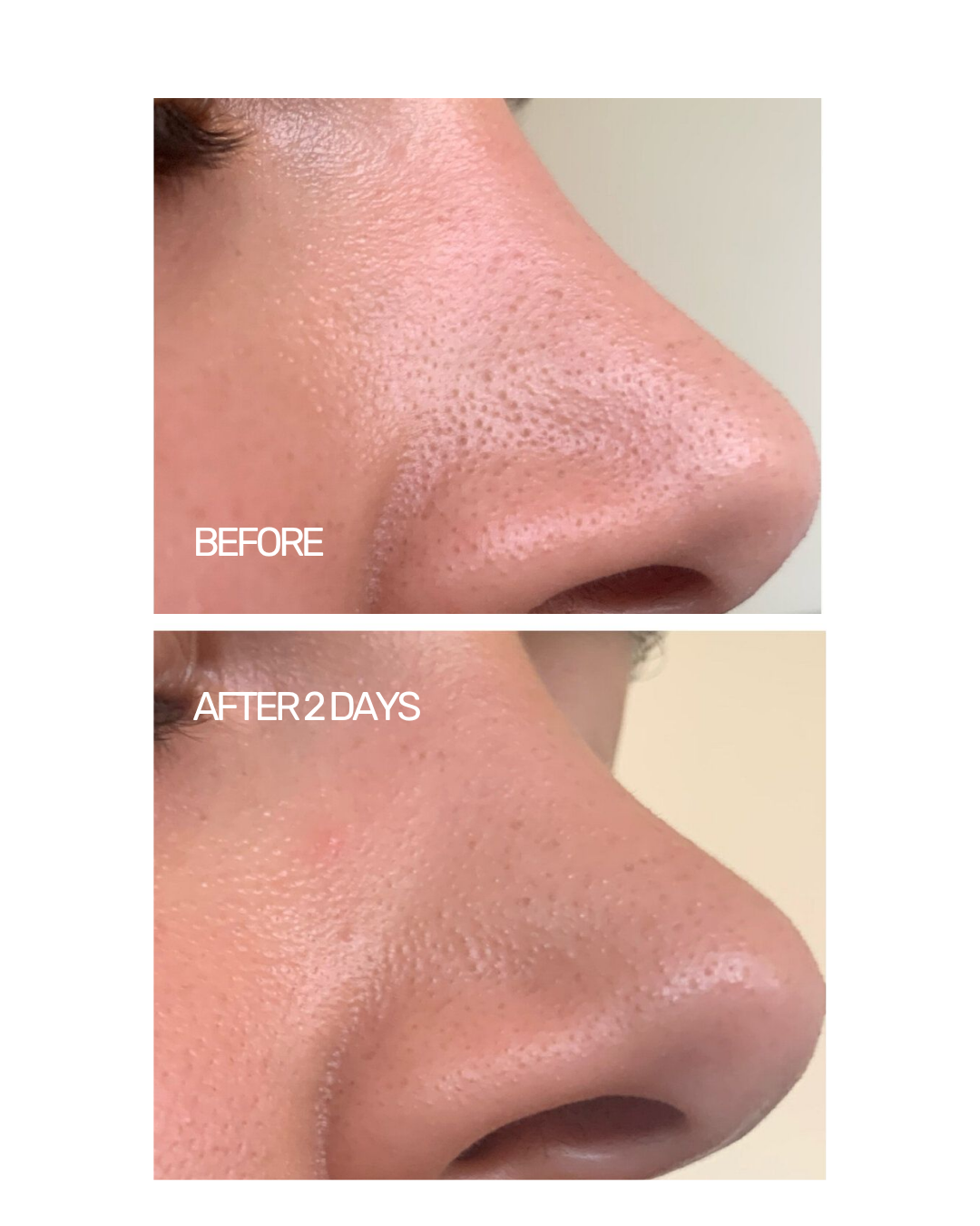 Biomimetic Purifying Cleanser