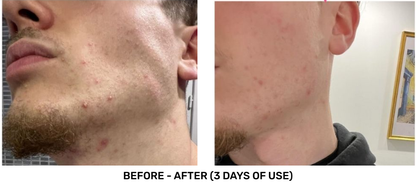 STEP 1: Biomimetic Cleanser | Moisturizing and Purifying