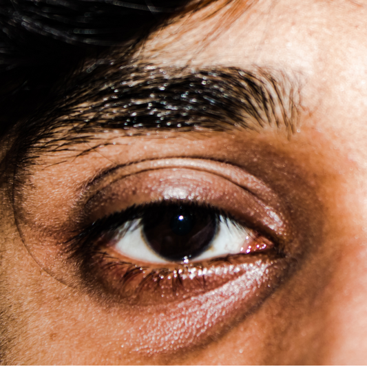 Dark circles: how can I make them disappear?