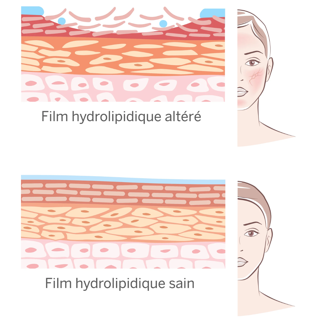 What is the role of the hydrolipidic film?