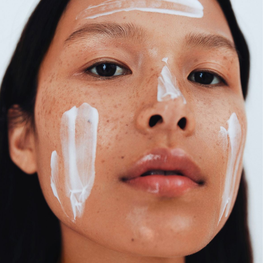 ¿Cuáles son las soluciones para tratar el acné hormonal?